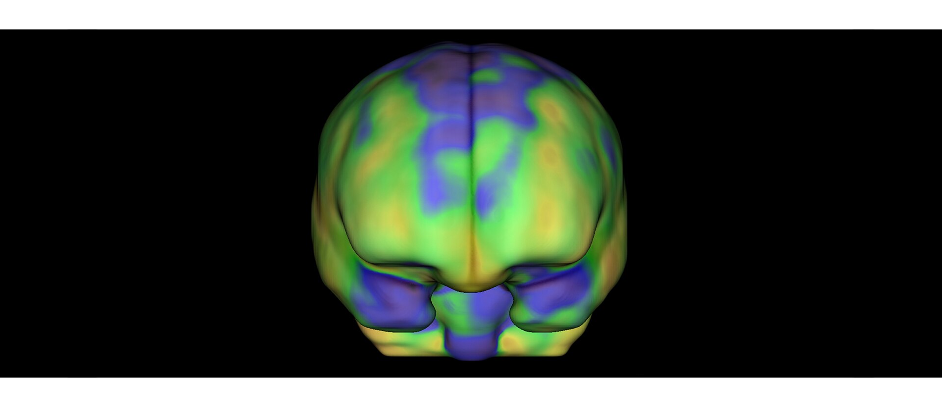 GEHCXeleris4DRQBrainImage1v1